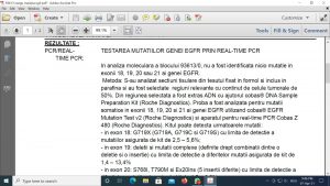 Test RT-PCR a pacientei dr. Cacovean